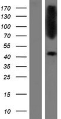 Western Blot: CTNS Overexpression Lysate (Adult Normal) [NBP2-09811] Left-Empty vector transfected control cell lysate (HEK293 cell lysate); Right -Over-expression Lysate for CTNS.