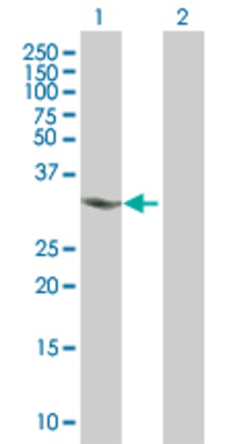 Lane 1: CHMP4A transfected lysate (24.53 KDa). Lane 2: Non-transfected lysate.