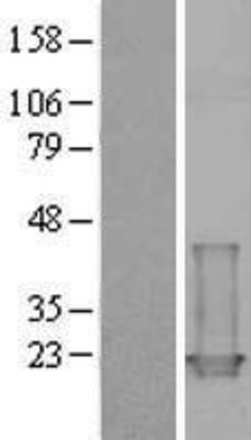 Western Blot: Troponin C (cardiac) Overexpression Lysate (Adult Normal) [NBL1-17176] Left-Empty vector transfected control cell lysate (HEK293 cell lysate); Right -Over-expression Lysate for Troponin C (cardiac).