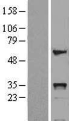 Western Blot: HOXB5 Overexpression Lysate (Adult Normal) [NBL1-11672] Left-Empty vector transfected control cell lysate (HEK293 cell lysate); Right -Over-expression Lysate for HOXB5.