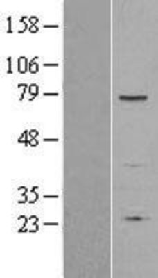 Western Blot: SENP1 Overexpression Lysate (Adult Normal) [NBL1-15808] Left-Empty vector transfected control cell lysate (HEK293 cell lysate); Right -Over-expression Lysate for SENP1.