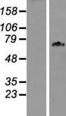 Western Blot: WDPCP Overexpression Lysate (Adult Normal) [NBL1-12614] Left-Empty vector transfected control cell lysate (HEK293 cell lysate); Right -Over-expression Lysate for WDPCP.