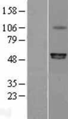 Western Blot: P2X6 Overexpression Lysate (Adult Normal) [NBL1-14032] Left-Empty vector transfected control cell lysate (HEK293 cell lysate); Right -Over-expression Lysate for P2X6.