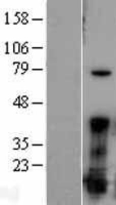 Western Blot: FGF1 Overexpression Lysate (Adult Normal) [NBP2-09719] Left-Empty vector transfected control cell lysate (HEK293 cell lysate); Right -Over-expression Lysate for FGF1.