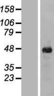 Western Blot: ITPK1 Overexpression Lysate (Adult Normal) [NBP2-09660] Left-Empty vector transfected control cell lysate (HEK293 cell lysate); Right -Over-expression Lysate for ITPK1.