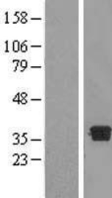 Western Blot: DHRS7B Overexpression Lysate (Adult Normal) [NBL1-09872] Left-Empty vector transfected control cell lysate (HEK293 cell lysate); Right -Over-expression Lysate for DHRS7B.
