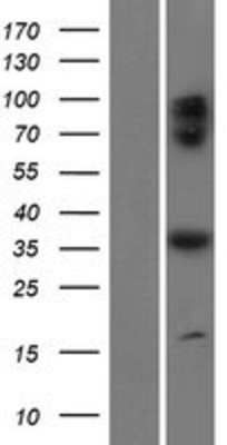 Western Blot: C17orf59 Overexpression Lysate (Adult Normal) [NBP2-10228] Left-Empty vector transfected control cell lysate (HEK293 cell lysate); Right -Over-expression Lysate for C17orf59.