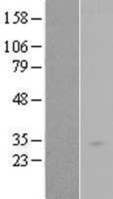 Western Blot: RAB34 Overexpression Lysate (Adult Normal) [NBL1-15063] Left-Empty vector transfected control cell lysate (HEK293 cell lysate); Right -Over-expression Lysate for RAB34.