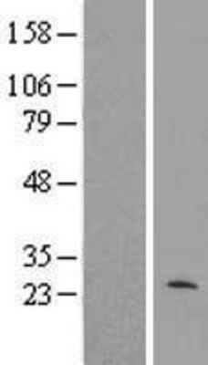 Western Blot: MRPL40 Overexpression Lysate (Adult Normal) [NBL1-13267] Left-Empty vector transfected control cell lysate (HEK293 cell lysate); Right -Over-expression Lysate for MRPL40.
