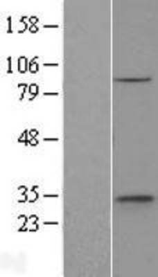 Western Blot: ethanolamine kinase Overexpression Lysate (Adult Normal) [NBL1-10354] Left-Empty vector transfected control cell lysate (HEK293 cell lysate); Right -Over-expression Lysate for ethanolamine kinase.