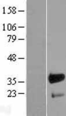 Western Blot: FHL3 Overexpression Lysate (Adult Normal) [NBL1-10716] Left-Empty vector transfected control cell lysate (HEK293 cell lysate); Right -Over-expression Lysate for FHL3.
