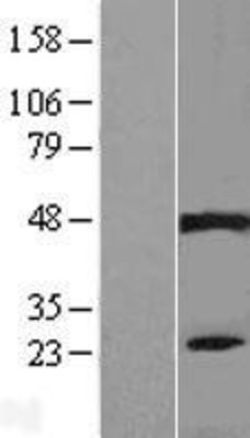 Western Blot: PIP5KL1 Overexpression Lysate (Adult Normal) [NBL1-14437] Left-Empty vector transfected control cell lysate (HEK293 cell lysate); Right -Over-expression Lysate for PIP5KL1.