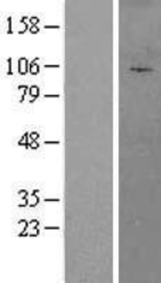 Western Blot: AFTPH Overexpression Lysate (Adult Normal) [NBL1-07376] Left-Empty vector transfected control cell lysate (HEK293 cell lysate); Right -Over-expression Lysate for AFTPH.
