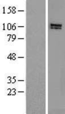 Western Blot: HPS3 Overexpression Lysate (Adult Normal) [NBL1-11697] Left-Empty vector transfected control cell lysate (HEK293 cell lysate); Right -Over-expression Lysate for HPS3.