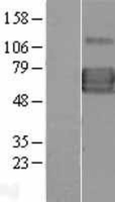 Western Blot: IL13 receptor alpha 1 Overexpression Lysate (Adult Normal) [NBL1-11905] Left-Empty vector transfected control cell lysate (HEK293 cell lysate); Right -Over-expression Lysate for IL13 receptor alpha 1.