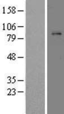 Western Blot: Plasminogen Overexpression Lysate (Adult Normal) [NBL1-14513] Left-Empty vector transfected control cell lysate (HEK293 cell lysate); Right -Over-expression Lysate for Plasminogen.