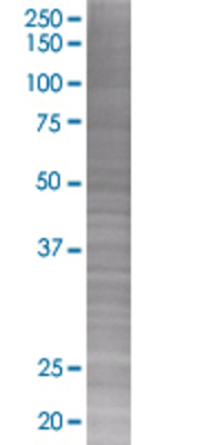 CXCR6 transfected lysate