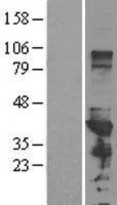 Western Blot: PCBP1 Overexpression Lysate (Adult Normal) [NBL1-14142] Left-Empty vector transfected control cell lysate (HEK293 cell lysate); Right -Over-expression Lysate for PCBP1.