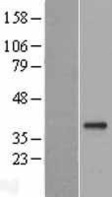 Western Blot: GDF15 Overexpression Lysate (Adult Normal) [NBL1-11024] Left-Empty vector transfected control cell lysate (HEK293 cell lysate); Right -Over-expression Lysate for GDF15.