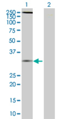 Lane 1: CXCR6 transfected lysate (39.3 KDa). Lane 2: Non-transfected lysate.