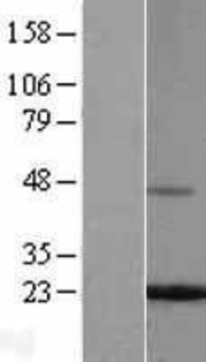Western Blot: Ferritin Light Chain Overexpression Lysate (Adult Normal) [NBL1-10851] Left-Empty vector transfected control cell lysate (HEK293 cell lysate); Right -Over-expression Lysate for Ferritin Light Chain.