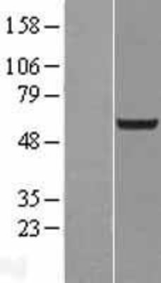 Western Blot: TFCP2L1 Overexpression Lysate (Adult Normal) [NBL1-16834] Left-Empty vector transfected control cell lysate (HEK293 cell lysate); Right -Over-expression Lysate for TFCP2L1.