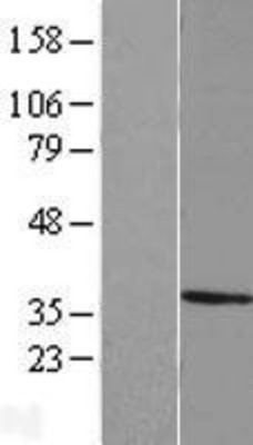 Western Blot: MPPED2 Overexpression Lysate (Adult Normal) [NBL1-13208] Left-Empty vector transfected control cell lysate (HEK293 cell lysate); Right -Over-expression Lysate for MPPED2.