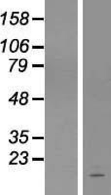 Western Blot: C1orf31 Overexpression Lysate (Adult Normal) [NBL1-08318] Left-Empty vector transfected control cell lysate (HEK293 cell lysate); Right -Over-expression Lysate for C1orf31.