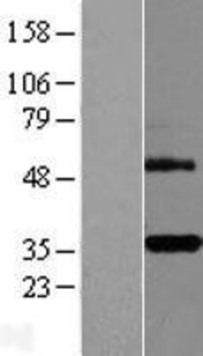 Western Blot: DcR3 Overexpression Lysate (Adult Normal) [NBL1-17158] Left-Empty vector transfected control cell lysate (HEK293 cell lysate); Right -Over-expression Lysate for DcR3.