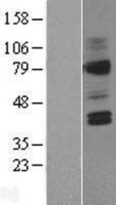 Western Blot: AVPR2 Overexpression Lysate (Adult Normal) [NBL1-07867] Left-Empty vector transfected control cell lysate (HEK293 cell lysate); Right -Over-expression Lysate for AVPR2.