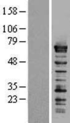 Western Blot: Splicing Factor 1 Overexpression Lysate (Adult Normal) [NBL1-15873] Left-Empty vector transfected control cell lysate (HEK293 cell lysate); Right -Over-expression Lysate for Splicing Factor 1.