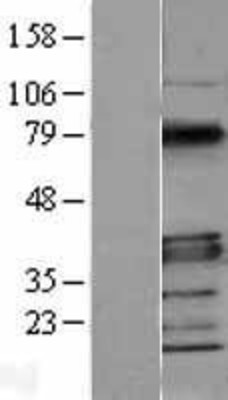 Western Blot: MyD88 Overexpression Lysate (Adult Normal) [NBL1-13419] Left-Empty vector transfected control cell lysate (HEK293 cell lysate); Right -Over-expression Lysate for MyD88.