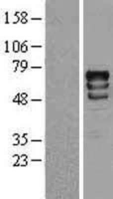 Western Blot: S6K Overexpression Lysate (Adult Normal) [NBL1-15574] Left-Empty vector transfected control cell lysate (HEK293 cell lysate); Right -Over-expression Lysate for S6K.