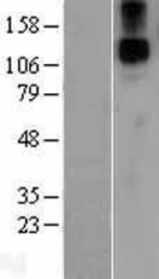 Western Blot: Jagged1 Overexpression Lysate (Adult Normal) [NBL1-12091] Left-Empty vector transfected control cell lysate (HEK293 cell lysate); Right -Over-expression Lysate for Jagged1.