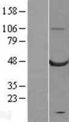 Western Blot: Calsequestrin 2 Overexpression Lysate (Adult Normal) [NBL1-08720] Left-Empty vector transfected control cell lysate (HEK293 cell lysate); Right -Over-expression Lysate for Calsequestrin 2.