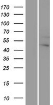Western Blot: G protein alpha 12 Overexpression Lysate (Adult Normal) [NBP2-10367] Left-Empty vector transfected control cell lysate (HEK293 cell lysate); Right -Over-expression Lysate for G protein alpha 12.