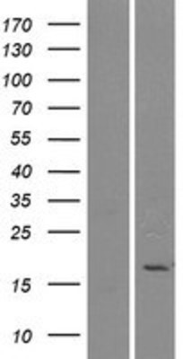 Western Blot: Phospholipase A2 IIE Overexpression Lysate (Adult Normal) [NBP2-10315] Left-Empty vector transfected control cell lysate (HEK293 cell lysate); Right -Over-expression Lysate for Phospholipase A2 IIE.