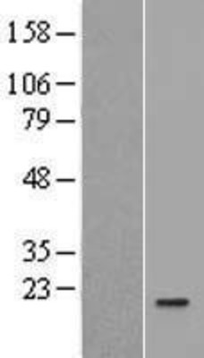 Western Blot: IL1F5 Overexpression Lysate (Adult Normal) [NBL1-11924] Left-Empty vector transfected control cell lysate (HEK293 cell lysate); Right -Over-expression Lysate for IL1F5.