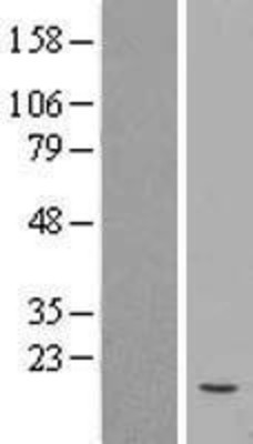 Western Blot: proBNP Overexpression Lysate (Adult Normal) [NBL1-13753] Left-Empty vector transfected control cell lysate (HEK293 cell lysate); Right -Over-expression Lysate for proBNP.