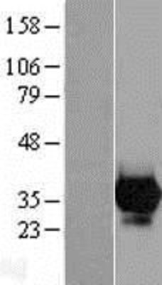 Western Blot: CA7 Overexpression Lysate (Adult Normal) [NBL1-08618] Left-Empty vector transfected control cell lysate (HEK293 cell lysate); Right -Over-expression Lysate for CA7.