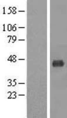Western Blot: MCAT Overexpression Lysate (Adult Normal) [NBL1-12943] Left-Empty vector transfected control cell lysate (HEK293 cell lysate); Right -Over-expression Lysate for MCAT.