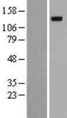 Western Blot: Robo4 Overexpression Lysate (Adult Normal) [NBL1-15473] Left-Empty vector transfected control cell lysate (HEK293 cell lysate); Right -Over-expression Lysate for Robo4.