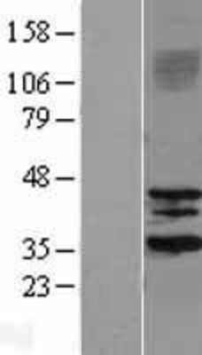 Western Blot: SIRT3 Overexpression Lysate (Adult Normal) [NBL1-15975] Left-Empty vector transfected control cell lysate (HEK293 cell lysate); Right -Over-expression Lysate for SIRT3.