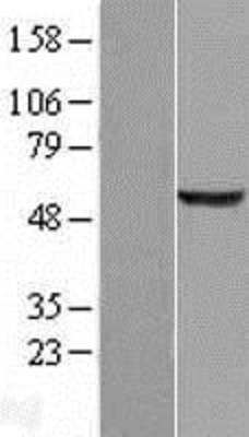 Western Blot: NARFL Overexpression Lysate (Adult Normal) [NBL1-13480] Left-Empty vector transfected control cell lysate (HEK293 cell lysate); Right -Over-expression Lysate for NARFL.