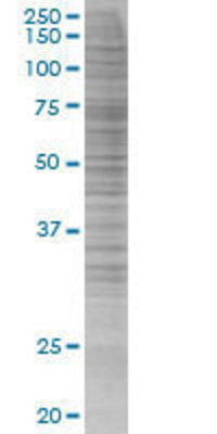 POMC transfected lysate.