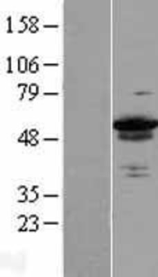 Western Blot: ZC3H15 Overexpression Lysate (Adult Normal) [NBL1-17983] Left-Empty vector transfected control cell lysate (HEK293 cell lysate); Right -Over-expression Lysate for ZC3H15.