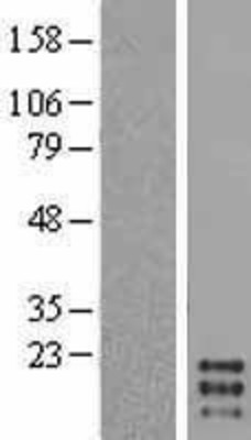 Western Blot: GM-CSF Overexpression Lysate (Adult Normal) [NBL1-09515] Left-Empty vector transfected control cell lysate (HEK293 cell lysate); Right -Over-expression Lysate for GM-CSF.