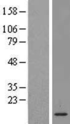 Western Blot: LSM2 Overexpression Lysate (Adult Normal) [NBL1-12725] Left-Empty vector transfected control cell lysate (HEK293 cell lysate); Right -Over-expression Lysate for LSM2.