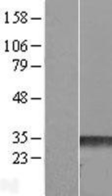 Western Blot: RND3 Overexpression Lysate (Adult Normal) [NBL1-15405] Left-Empty vector transfected control cell lysate (HEK293 cell lysate); Right -Over-expression Lysate for RND3.