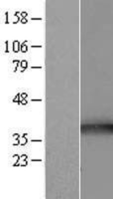 Western Blot: TOMM34 Overexpression Lysate (Adult Normal) [NBL1-17191] Left-Empty vector transfected control cell lysate (HEK293 cell lysate); Right -Over-expression Lysate for TOMM34.
